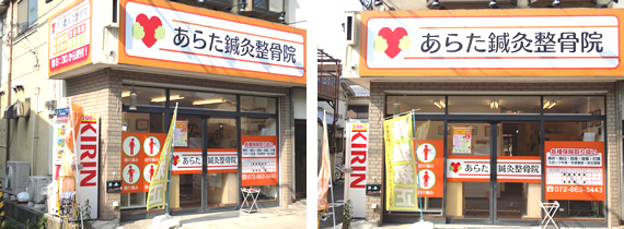 あらた鍼灸整骨院外観